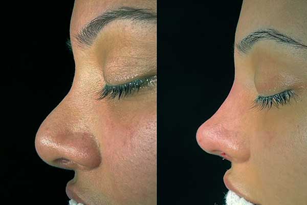 📸 قبل وبعد