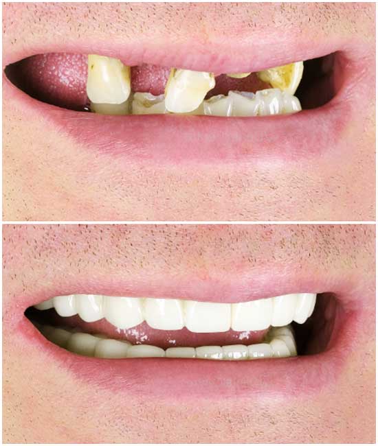 📸 قبل وبعد