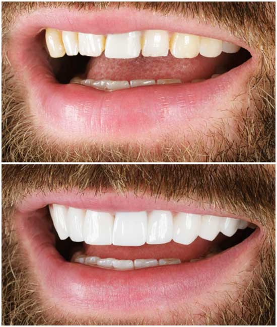 📸 قبل وبعد