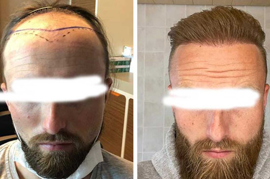 📸 قبل وبعد